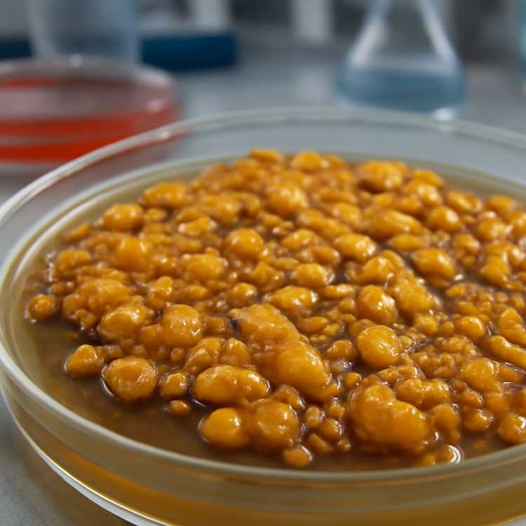 Колонии S aureus — уникальные пигменты и их значение в микробиологии Колонии S aureus — уникальные пигменты и их значение в микробиологии